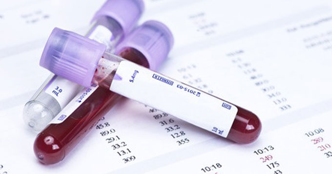 blood test tubes