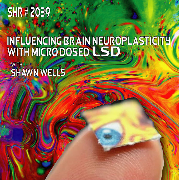 brain neuroplasticity