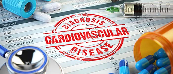 cvd - cardiovascular disease