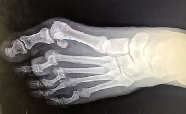 large foot