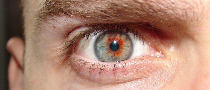 eye color