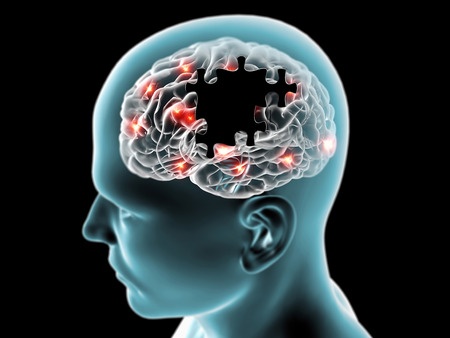SHR # 2153 :: Food Hangovers + UCI Cracks Code to Restoring Memory Creation in Older or Damaged Brains ::