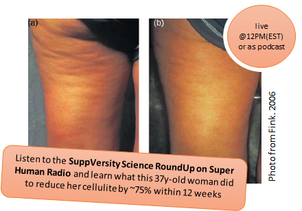 SHR # 2192 :: SPECIAL EPISODE :: SuppVersity Science Roundup: You Don't Have To Live With Cellulite PLUS Physical Culture At Its Best: BodyTribe Fitness ::
