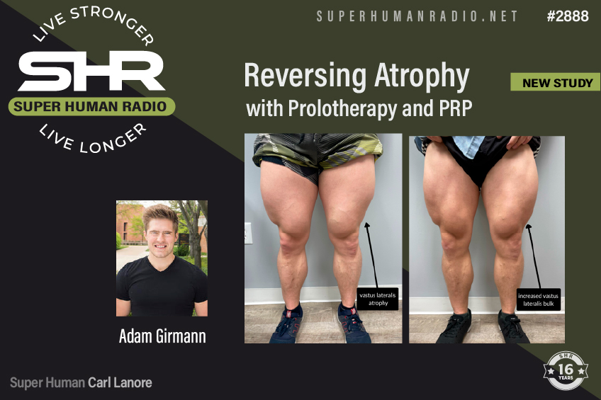 Reversing Atrophywith Prolotherapy and PRP; New Study