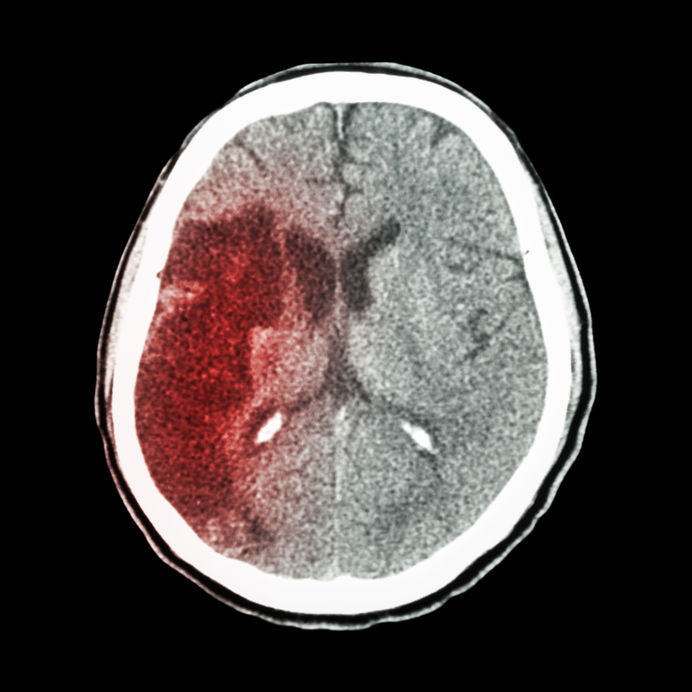 brain imagery