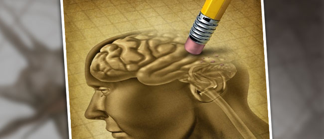 partially erased human brain illustration depicting memory loss