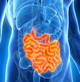 intestinal inflammation